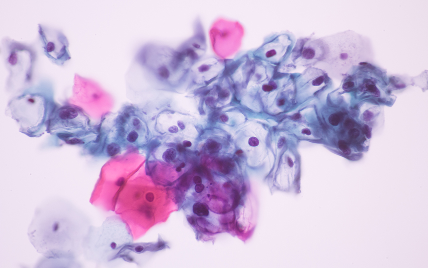 Μολυσματική Τέρμινθος | DermaMedica