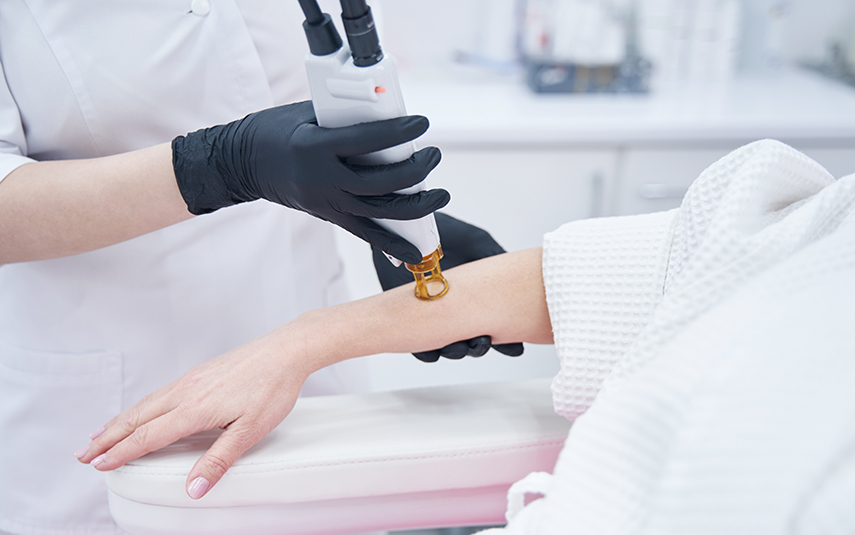 Αποτρίχωση Laser Αλεξανδρίτη Candela | DermaMedica