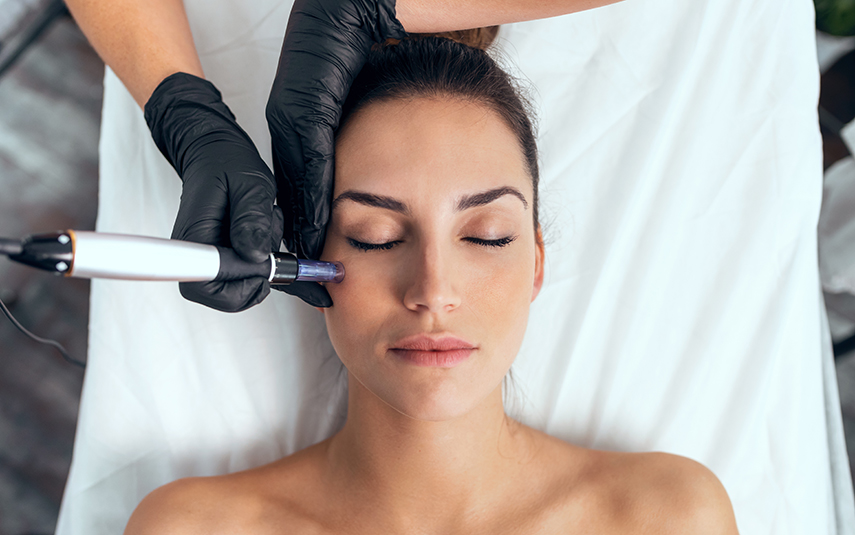 Microneedling στο DermaMedica – Ανάπλαση, Σύσφιξη & Λάμψη Δέρματος