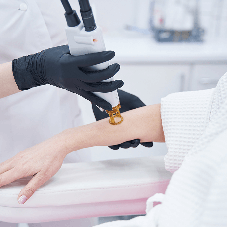 Αποτρίχωση Laser Αλεξανδρίτη Candela | DermaMedica