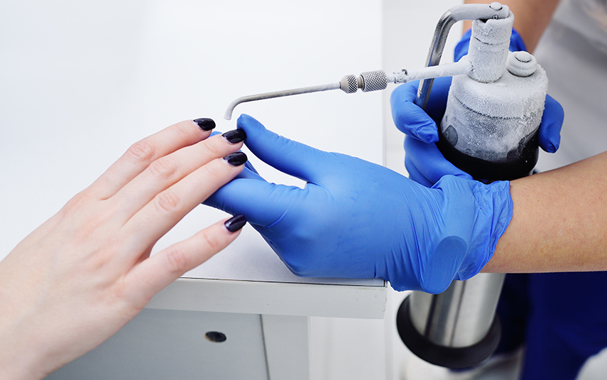 Κρυοχειρουργική για Δερματικές Βλάβες – Τι Είναι & Πώς Λειτουργεί | DermaMedica