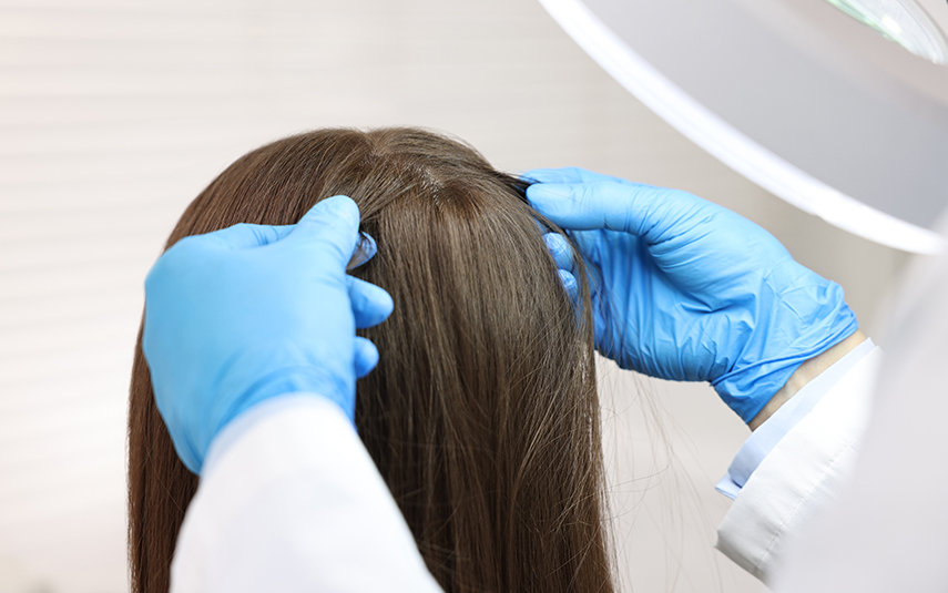 Φθειρίαση (Ψείρες) | Αντιμετώπιση & Πρόληψη | DermaMedica Άγιος Στέφανος