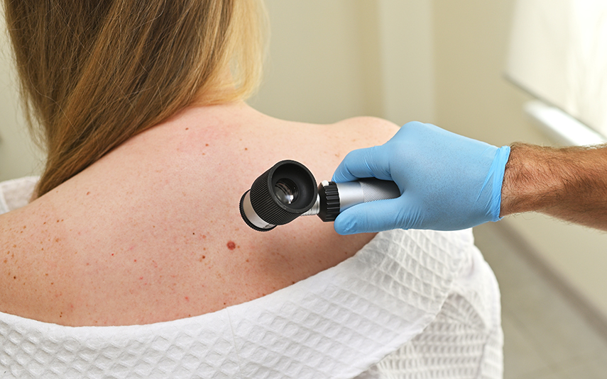 Καρκίνοι του Δέρματος | Διάγνωση & Αντιμετώπιση | DermaMedica Θεσσαλονίκη