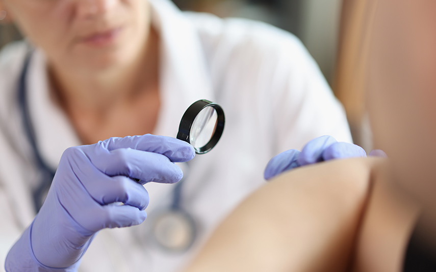 Λοιμώξεις του Δέρματος | Συμπτώματα & Θεραπεία | DermaMedica Άγιος Στέφανος