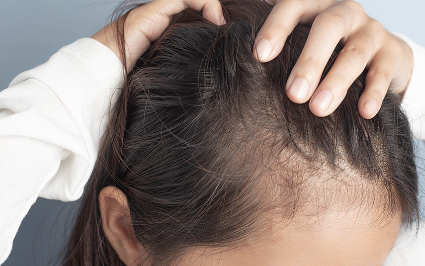 Παθήσεις Τριχών – Διάγνωση & Θεραπεία | DermaMedica