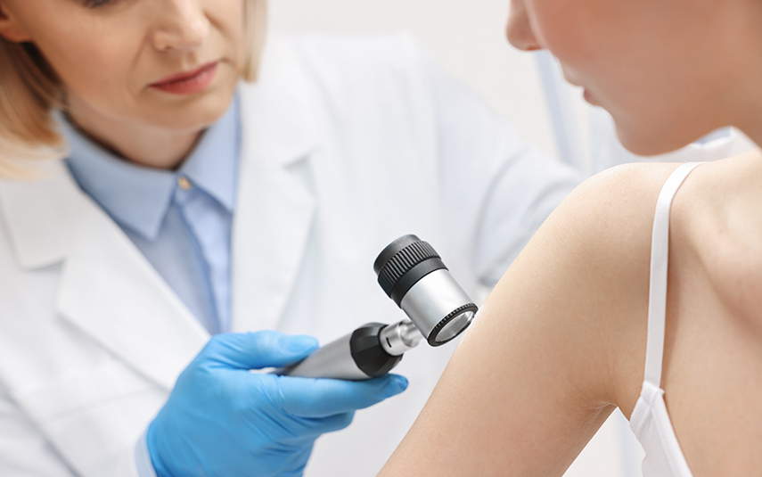 Σμηγματορροϊκές Υπερκερατώσεις | Αντιμετώπιση & Αφαίρεση | DermaMedica Άγιος Στέφανος