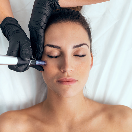Microneedling στο DermaMedica – Ανάπλαση, Σύσφιξη & Λάμψη Δέρματος